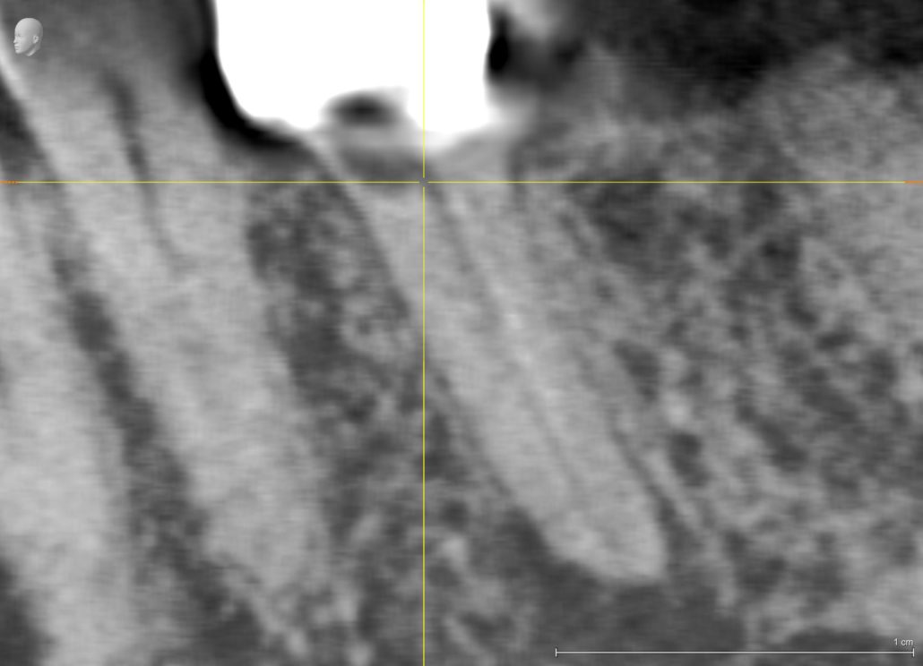 Anonymous_Patient_3D examination(1)_VO2_20180614_122500_Longitudinal